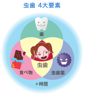 むし歯 4大要素